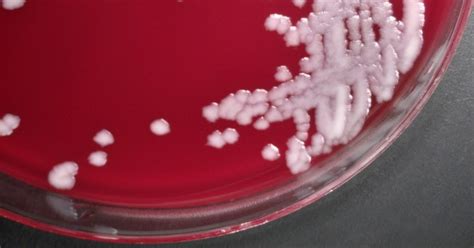 CDC moves to contain anthrax exposure