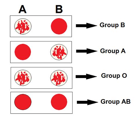 Reverse Blood Grouping: Principle, Procedure, Interpretation and ...