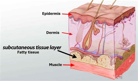 Subcutaneous injection sites, how to give subcutaneous injection & technique