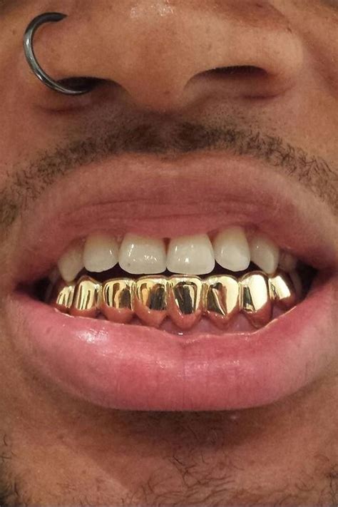 18K Real Gold Braces Punk Hiphop Multicolor Diamond Custom Bottom Teeth Grillz Dental Mouth ...