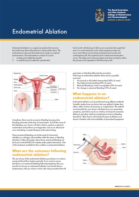 Endometrial Ablation — Dr Michael Wynn-Williams