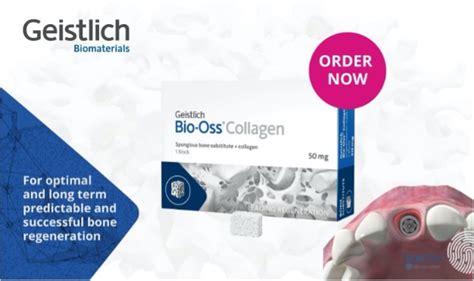 Featured Product: Geistlich Bio-Oss® Collagen - Sowingo