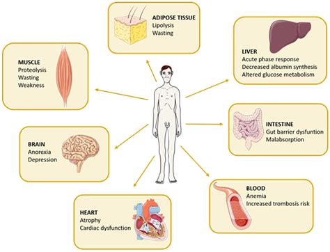 IJMS | Free Full-Text | Targeting Gut Microbiota in Cancer Cachexia: Towards New Treatment Options