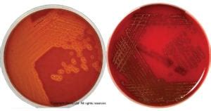 Columbia Agar with 5% Sheep Blood- Composition, Principle, Preparation, Results, Uses