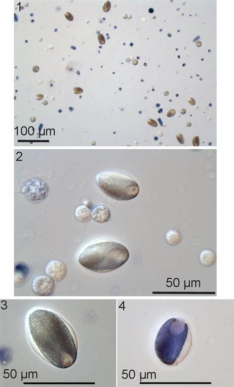 Slime Gland Cytology and Mechanisms of Slime Thread Production in the ...