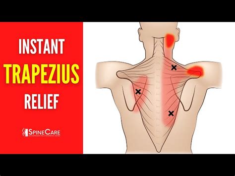 Trapezius Muscle: Anatomy, Function, Pain Causes, 52% OFF