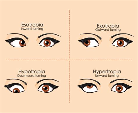 Visual Impairment: Causes, Symptoms And Treatment- Spectacular by Lenskart