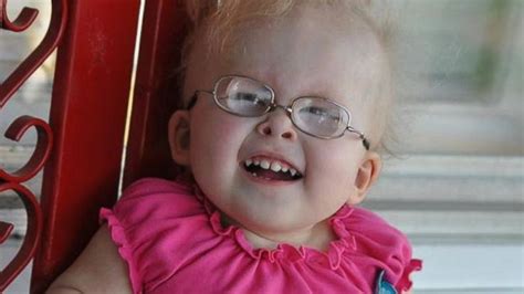 Toddler Overcomes Spine-Crushing Dwarfism to Sing | Dwarfism, Singing, Rare genetic disorders