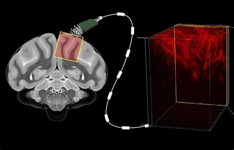 Reading Minds With Ultrasound: Caltech’s New Brain–Machine Interface