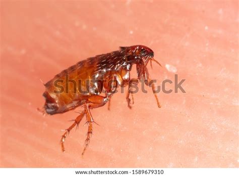 Flea On Human Skin Macro Stock Photo 1589679310 | Shutterstock