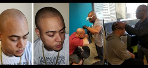 Scalp Micropigmentation Training | Micropigmentation Training