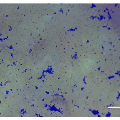 A) Cultured spirochetes from patient 3 tissue samples, 1000X darkfield... | Download Scientific ...