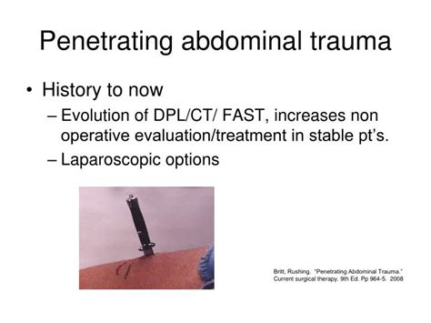 PPT - Ballistics in Penetrating Trauma PowerPoint Presentation - ID:1251961