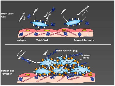 JCM | Free Full-Text | Diagnosis and Treatment of von Willebrand Disease and Rare Bleeding Disorders