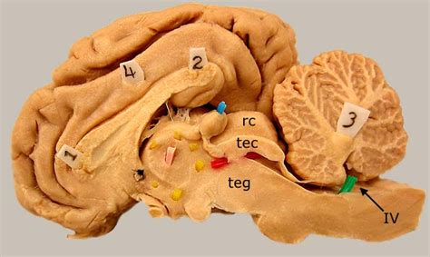 Tentorium Cerebelli Sheep Brain