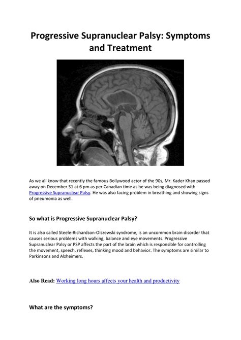 PPT - Progressive Supranuclear Palsy: Symptoms and Treatment PowerPoint Presentation - ID:8135376