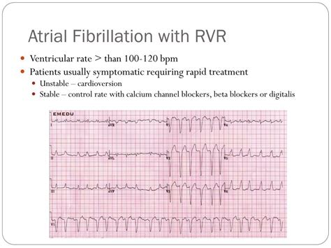 Afib With Rvr Treatment