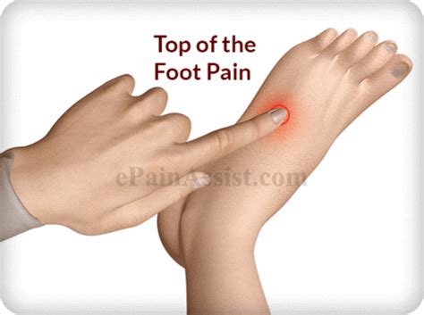 Top Of The Foot Pain GIF by ePainAssist - Find & Share on GIPHY