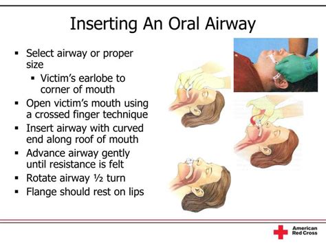 PPT - Airway Management PowerPoint Presentation - ID:5921479