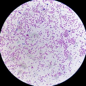 Premium Photo | Microscopic view of gram stain showing Escherichia coli or E coli bacteria