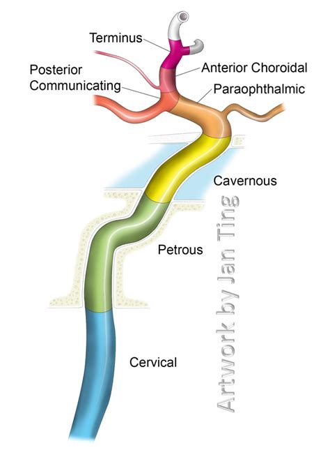 branches of ica by atlas anatomy - Google Search | Internal carotid artery, Carotid artery ...