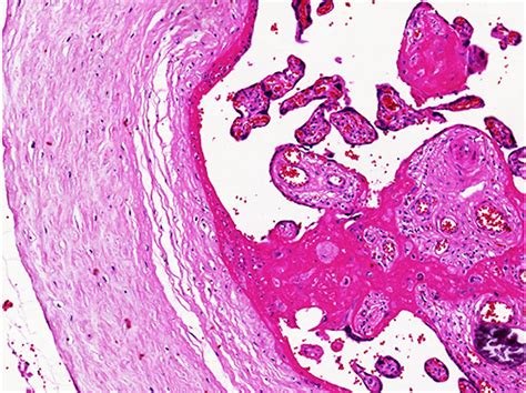 Placenta Histology Labeled