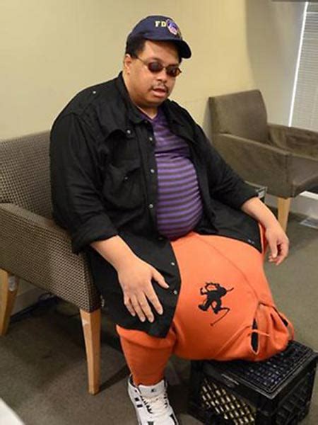 Man with huge scrotum seeks money for surgery - Global Times