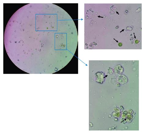 Microscopic view of the debris (dashed arrows show intact cells, black... | Download Scientific ...