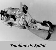 Tenodesis Splint | Orthotic & Prosthetic Product Reviews, Blogs, Videos ...