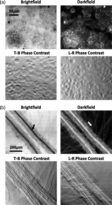 Real-time brightfield, darkfield, and phase contrast imaging in a light-emitting diode array ...