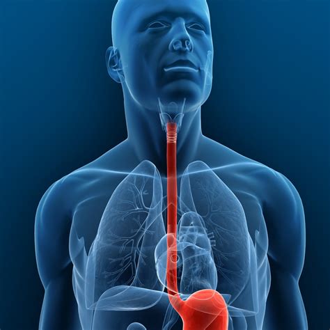 Cancer Health Basics: Esophageal Cancer - Cancer Health