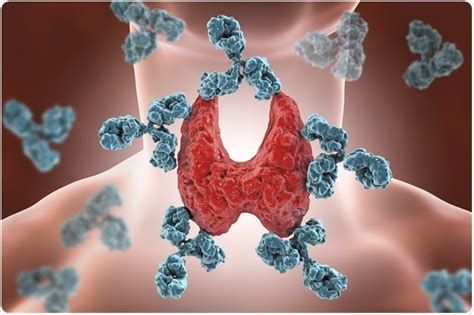 Treatment Options for Autoimmune Disease