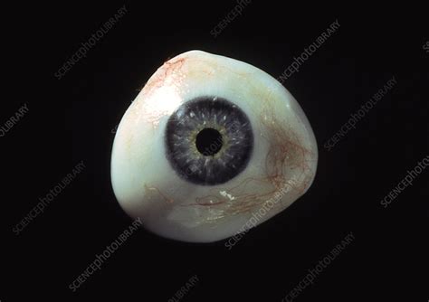 Artificial eye - Stock Image - M600/0003 - Science Photo Library