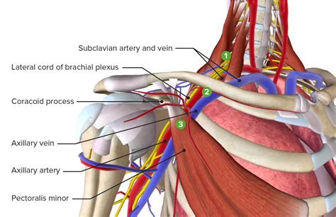 Thoracic-outlet-Syndrom - E-Learning mit Lecturio