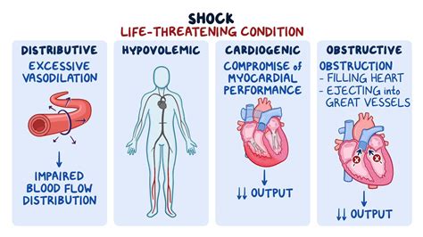 Cardiogenic Shock Signs And Symptoms