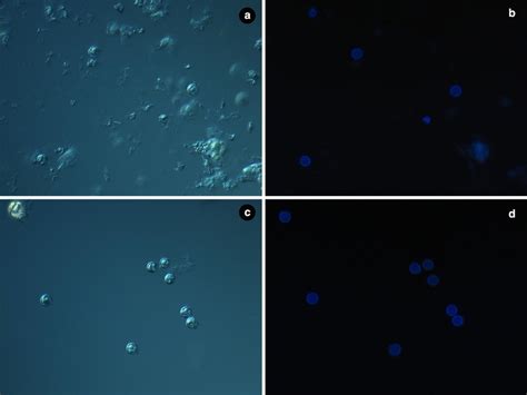 Microscopy images of oocysts after gradient purification without (a and... | Download Scientific ...