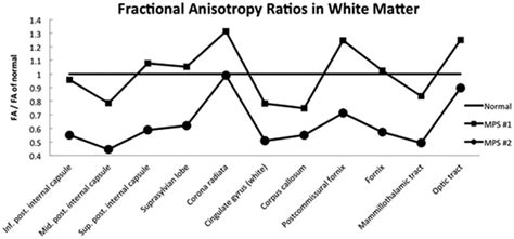 Fractional anisotropy values for the white matter ROIs in all brains... | Download Scientific ...