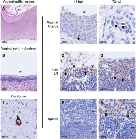 Intravaginal Infection Model - Creative Diagnostics