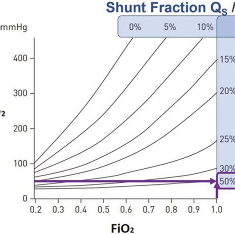 Iso‐shunt diagram, illustrating the relationship between PaO2 and FiO2... | Download Scientific ...