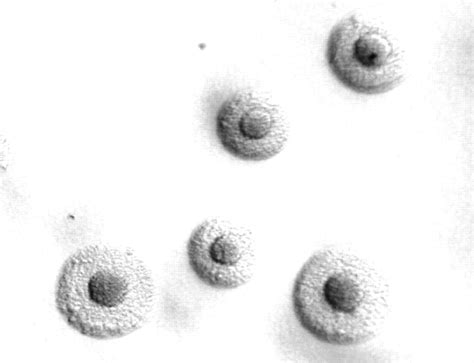 Klebsiella Pneumoniae Colony Morphology And Microscopic