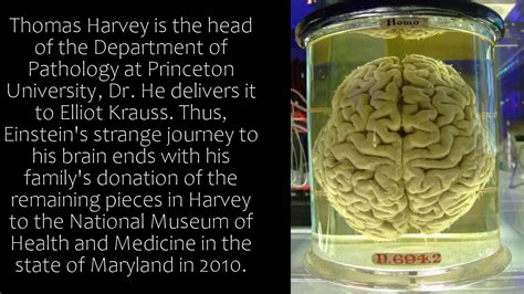 Albert Einsteins Brain In Jar