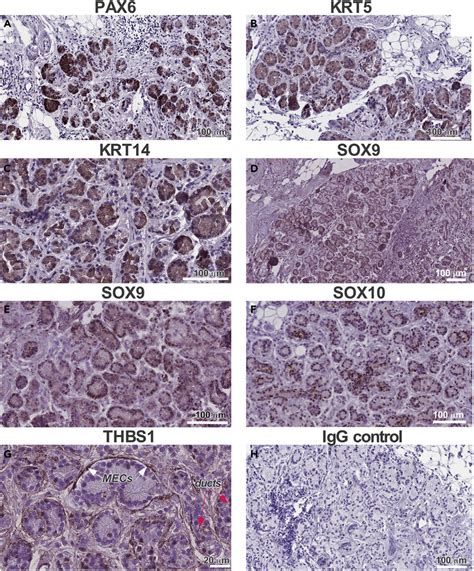 Expression of the Progenitor Cell Transcription Factors and Basal Cell ...