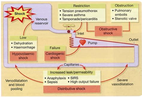 Circulatory Shock Diagram | Quizlet