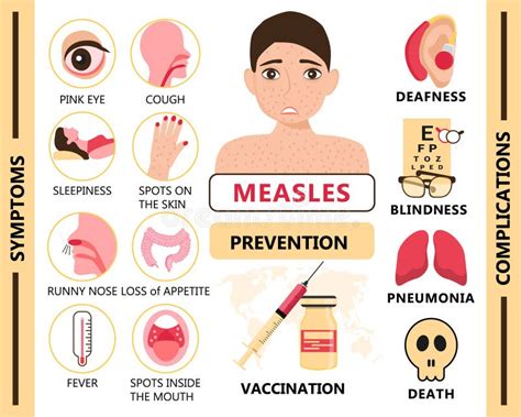 Measles Infographic Concept Vector. Infected Human with Papules on the ...