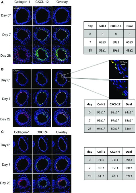 | Association between CXCL-12 and intimal hyperplasia (IH). Panels show ...