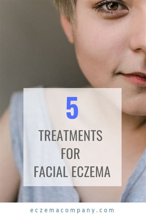 Pin on Eczema: Face + Eye + Eyelids