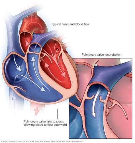 Pulmonary Valve Location