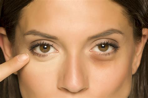 Learn How to Get Rid of Eye Bags | ReadingGlasses.com