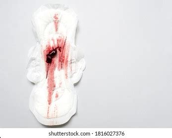 49 imágenes de Blood clots period - Imágenes, fotos y vectores de stock | Shutterstock