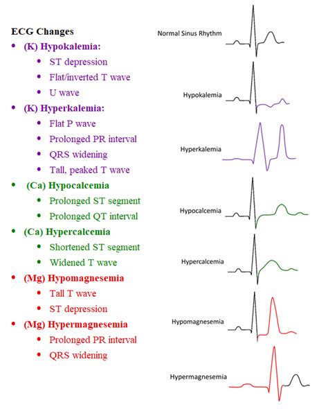 Visual for ECG changes for different electrolyte imbalances | Nursing ...